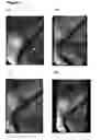 Fig. 07 - Methods and systems for restoring patency