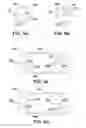 Fig. 04 - Oral care cleaning system utilizing entrained fluid
