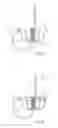 Fig. 02 - Devices, systems and methods for delivering a prosthetic mitral valve and anchoring device