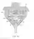 Fig. 04 - Locking gastric obstruction device and method of use