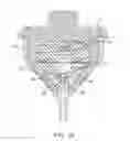 Fig. 06 - Locking gastric obstruction device and method of use