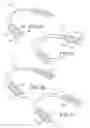 Fig. 13 - Custom-fit dental guard