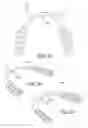Fig. 14 - Custom-fit dental guard