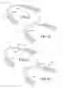 Fig. 18 - Custom-fit dental guard