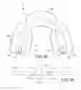 Fig. 20 - Custom-fit dental guard