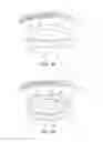 Fig. 03 - Dry eye treatment systems