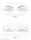 Fig. 06 - Dry eye treatment systems