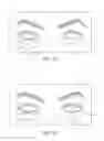 Fig. 09 - Dry eye treatment systems
