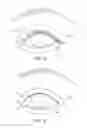 Fig. 12 - Dry eye treatment systems