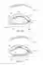 Fig. 13 - Dry eye treatment systems