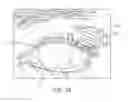 Fig. 15 - Dry eye treatment systems