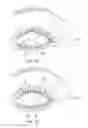Fig. 18 - Dry eye treatment systems