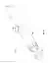 Fig. 17 - Intraocular delivery devices and methods therefor