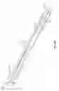 Fig. 25 - Intraocular delivery devices and methods therefor