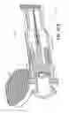 Fig. 47 - Intraocular delivery devices and methods therefor