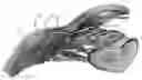 Fig. 01 - Device for treating glaucoma