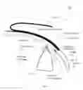 Fig. 02 - Device for treating glaucoma