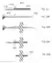Fig. 12 - Device for treating glaucoma