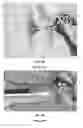 Fig. 03 - EXPANDABLE EAR APPARATUS AND METHODS OF USE