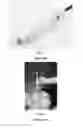 Fig. 04 - EXPANDABLE EAR APPARATUS AND METHODS OF USE