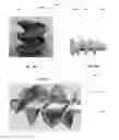 Fig. 06 - EXPANDABLE EAR APPARATUS AND METHODS OF USE