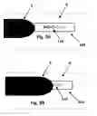 Fig. 06 - Method for tailoring a compression garment