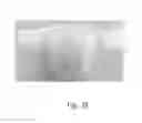 Fig. 34 - Configurable absorbent articles having improved bodily exudate visualization