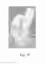 Fig. 35 - Configurable absorbent articles having improved bodily exudate visualization