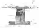 Fig. 01 - System, apparatus and method for supporting and/or positioning a patient before, during, or after a medical procedure