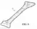 Fig. 08 - Single tube crutch and method of nesting and packaging the same