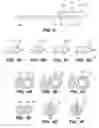 Fig. 03 - Double Lumen Integrated Enteral Feeding Assembly and a Method for Use Thereof
