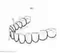 Fig. 04 - Preparation for attaching to teeth or surrounding part of teeth