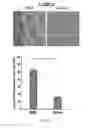 Fig. 03 - Method of treating metastatic cancer in a subject