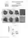 Fig. 08 - Method of treating metastatic cancer in a subject