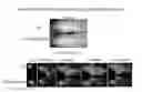 Fig. 01 - Neuroprotective peptides derived from activity-dependent neuroprotective protein for treatment of neurological diseases