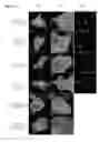 Fig. 19 - Neuroprotective peptides derived from activity-dependent neuroprotective protein for treatment of neurological diseases