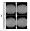 Fig. 08 - Enhancing health in mammals using telomerase reverse transcriptase gene therapy
