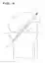 Fig. 05 - METHODS OF ACL REPAIR USING BIOLOGICALLY ACTIVE SUTURE
