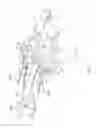 Fig. 06 - Deflectable sheath introducer