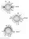 Fig. 09 - Deflectable sheath introducer