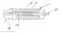 Fig. 01 - Helical balloon catheter
