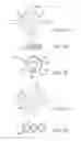 Fig. 04 - Helical balloon catheter