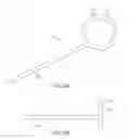 Fig. 07 - Helical balloon catheter
