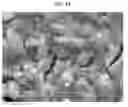 Fig. 03 - Neural electrode and manufacturing method thereof