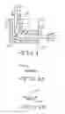 Fig. 07 - NEURAL ELECTRODE SYSTEM WITH A CARRIER HAVING A TAPE SPRING-TYPE SHAPE