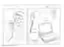 Fig. 01 - Devices and methods for sleep apnea treatment