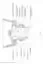 Fig. 06 - Devices and methods for sleep apnea treatment