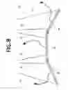 Fig. 09 - MYOPIA INHIBITION APPARATUS AND OCULAR METHOD