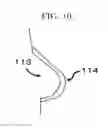 Fig. 08 - Bolus and method for producing same