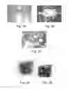 Fig. 03 - Method and device for radiotherapy